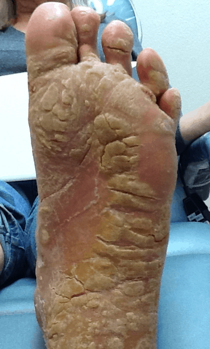 patient stories
